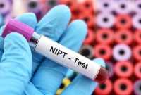 Fungsi NIPT Test untuk Ibu Hamil